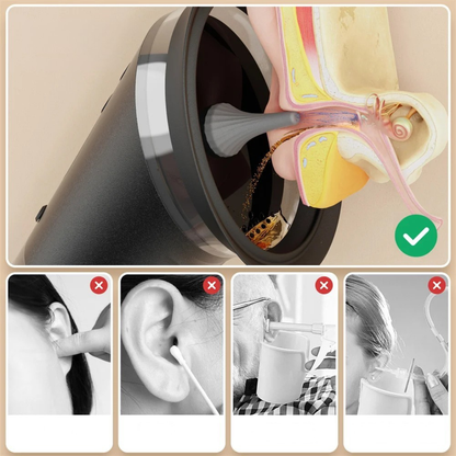 Limpiador Electrónico de Oídos para Eliminar el Cerumen